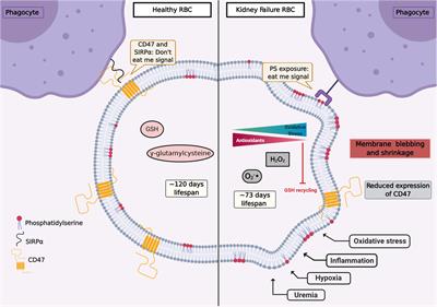 The Role of Eryptosis in the Pathogenesis of Renal Anemia: Insights From Basic Research and Mathematical Modeling